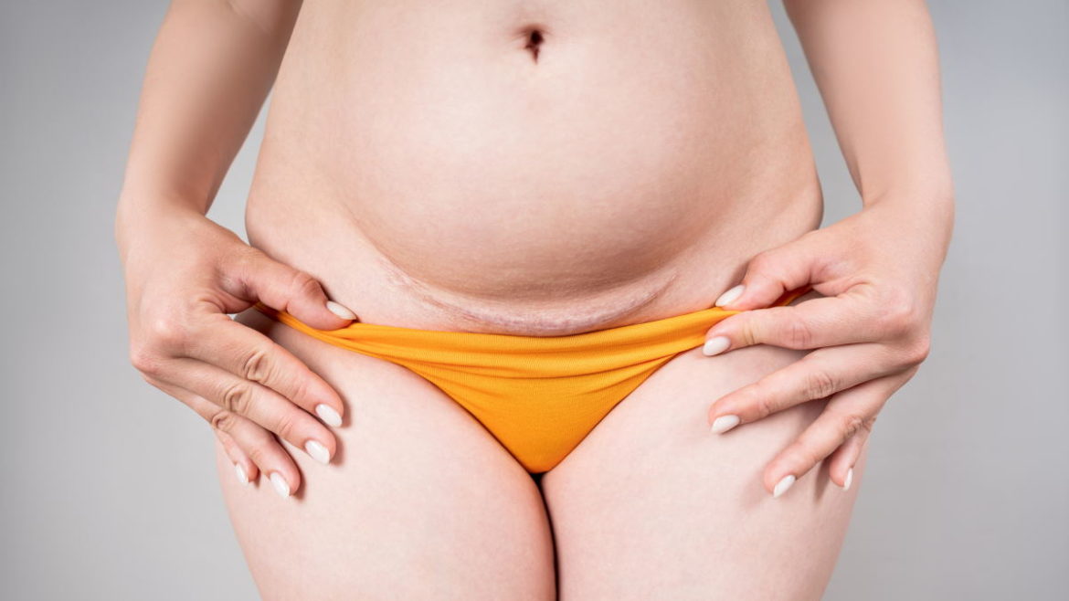 c section shelf