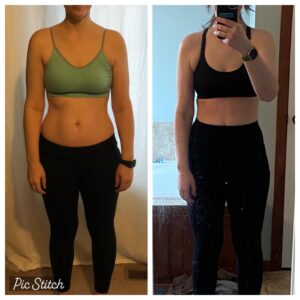 Before and after photos of rib flare