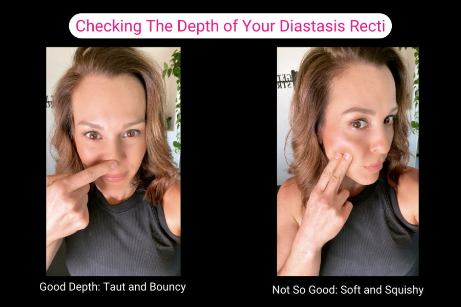 diastasis recti tension check