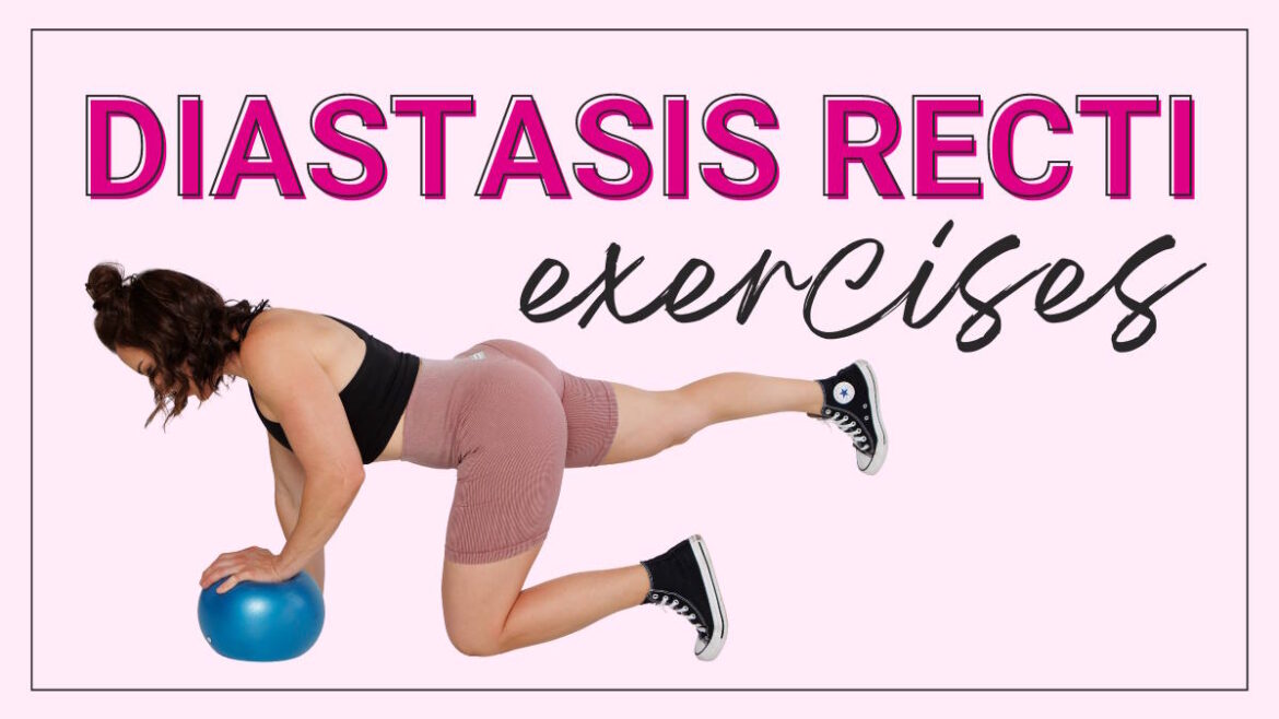diastasis recti exercises
