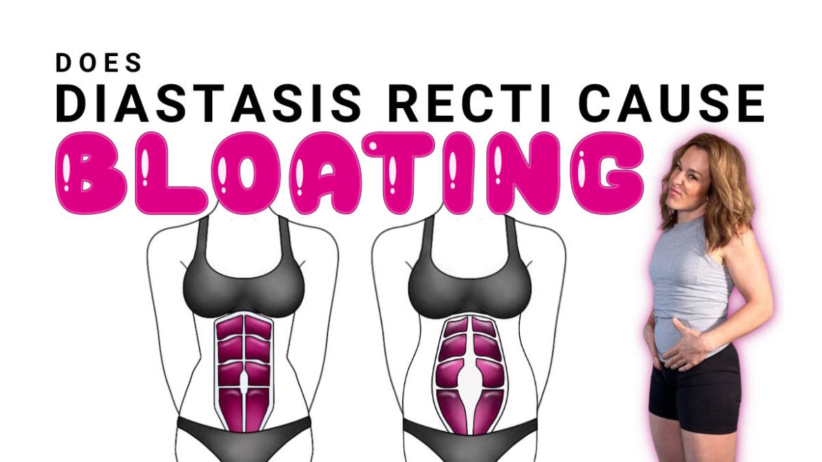 does diastasis recti cause bloating