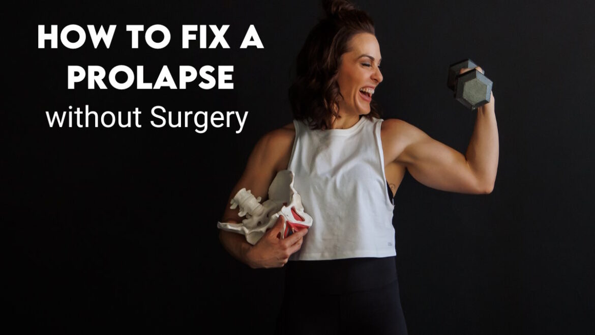 how to fix a prolapse without surgery