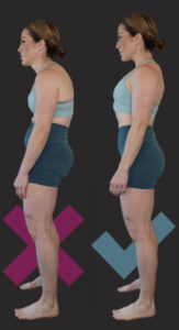posterior pelvic tilt