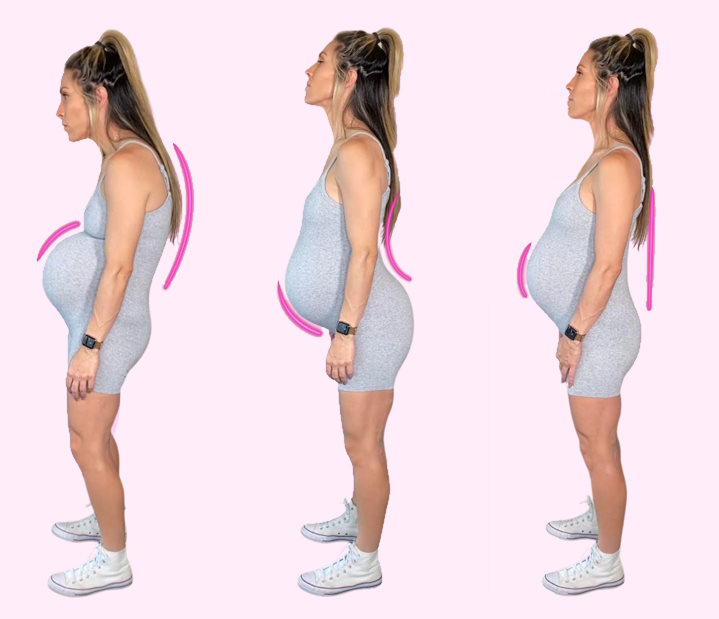 pregnancy posture comparison